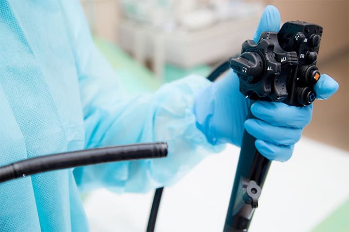 上部消化管内視鏡検査(胃カメラ/胃内視鏡検査)